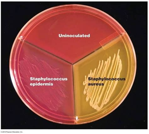 staphylococcus aureus mannitol salt agar.